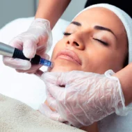 Facial Lifting